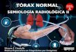 Radiografía de Tórax - Semiología Radiológica