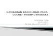 Gambaran Radiologis Pada occult pneumotoraks