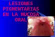 Class Lesiones Pigmentarias