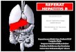 Referat Hepatitis b