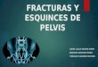 Fracturas y Esquinces de Pelvis