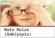 Mata Malas (Amblyopia)