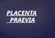 Obstetrica.placenta Praevia