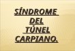 Sindrome Del Tunel Carpiano