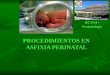 1.- Procedimientos en Asfixia Perinatal