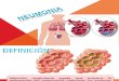 Alveolitis y Neumonia