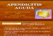 APENDICITIS AGUDA EXPOSICION