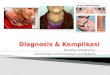 Diagnosis & Komplikasi by Citra