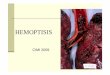 Hemoptisis (Clase)