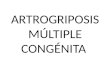 Manifestaciones clínicas (artrogriposis) (2)
