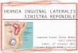 Hernia Inguinal Lateralis Sinistra Reponible