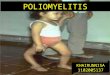 Poliomyelitis referat ilmu penyakit anak definis etiologi patofisiologi epidemiologi rumah sakit tingkat 2 muhmmad ridwan meuraksa