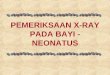 PEMERIKSAAN X-RAY PADA BAYI - NEONATUS.ppt