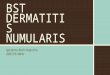 Prenetasi Dermatitis Numularis