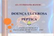Doença Ulcerosa Péptica