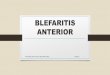 Blefaritis Anterior