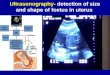 Ultrasonography- Ultrasonography- detection of size and shape of foetus in uterus