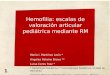 Hemofilia : escalas de valoración articular pediátrica mediante RM María I. Martínez León * Angeles Palomo Bravo ** Luisa Ceres Ruiz * * Radiología Pediátrica