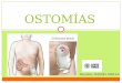 OSTOMÍAS Docente: DANIEL MELLA. ¿Qué es la ostomía? Una ostomía es una operación quirúrgica en la que se practica una abertura (estoma) en la pared abdominal
