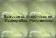 Estructuras Anatómicas en Radiografías Panorámicas