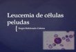 { Leucemia de células peludas Sergio Maldonado Cabrera