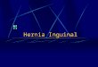 Hernia Inguinal. Números Incidencia 15:1000. 700,000 herniplastías inguinales se realizan por año en U.S.A