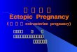异 位 妊 娠  Ectopic  Pregnancy