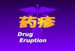 Drug     Eruption