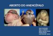 ABORTO DO ANENCÉFALO