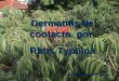 Dermatitis de contacto  por  Rhus Typhina