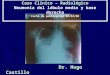 Caso Clínico – Radiológico Neumonía del lóbulo medio y base derecha Fecha de publicación 02/03/08