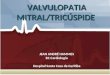 VALVULOPATIA MITRAL/TRICÚSPIDE  JEAN ANDRÉ HAMMES R1 Cardiologia Hospital Santa Casa de Curitiba