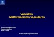 Vasculitis  Malformaciones vasculares