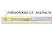 PHENOMENE DE  RAYNAUD