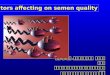 Factors affecting on semen quality