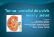 Tumor  urotelial de pelvis renal y uréter