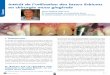 Ls 57 intérêt de l’utilisation des lasers erbiums en chirurgie muco gingivale