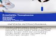 Referat Ppt Encephalitis Toksoplasma