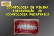 ODONTOLOGIA DE MÍNIMA INTERVENÇÃO EM ODONTOLOGIA PEDIÁTRICA