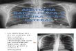 Anatomia Radiologica y Lectura de P-A y Lateral