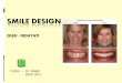 Smile Design 2hgh