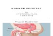 Presentation1,Prostat Cancer