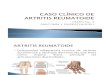 Caso Clinico Artritis Reumatoide Presentacion