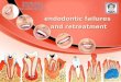 Endodontic failures