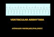 Ventricular aritmia (VT) Afdhalun Hakim, MD, FIHA, FAsCC