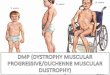Dmp (dystrophy muscular progressive