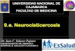 Infecciones del SNC Neurocisticercosis