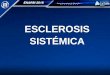 Esclerosis sistemica