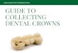 Guide to Collecting Dental Crowns