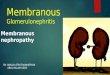 Membranous glomerulonephritis